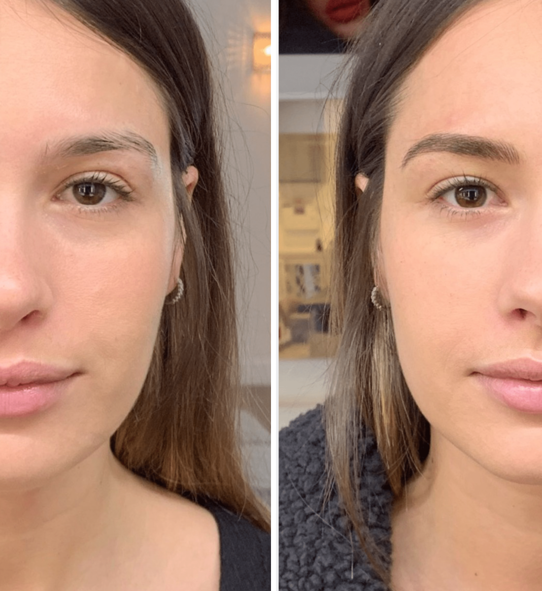 Kaş Ekimi Öncesi / Sonrası 4