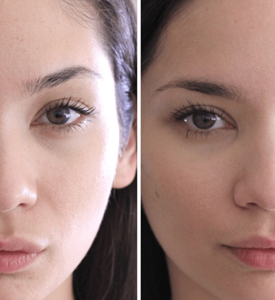 Kaş Ekimi Öncesi / Sonrası 2