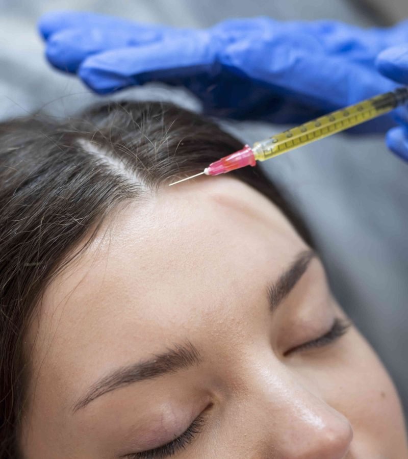 close-up-young-woman-getting-prp-injection_optimized