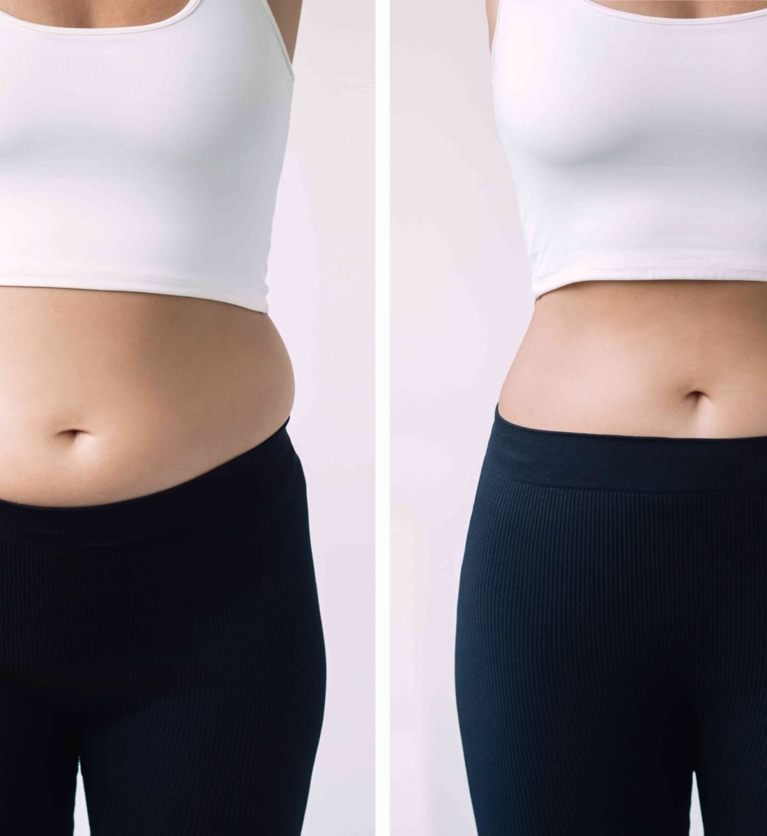 Obezite Cerrahisi Öncesi / Sonrası 2